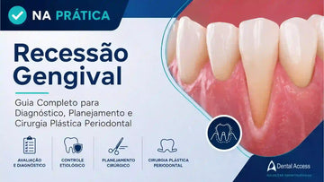 Odontologia na Prática: Guia de Materiais e Instrumentais para o Tratamento da Recessão Gengival