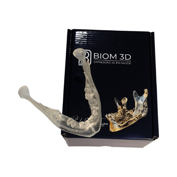 Mandíbula Implantodontia LSE - Biom 3D - Dental Access