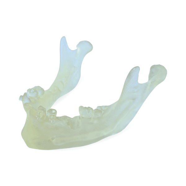 Mandíbula Implantodontia LSE - Biom 3D - Dental Access