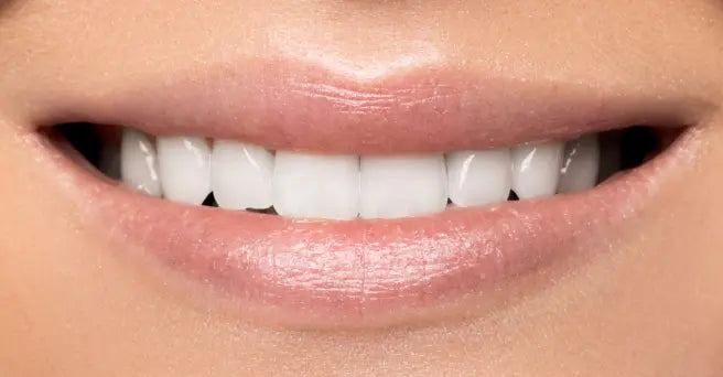 Clareador Odontológico | Dental Access