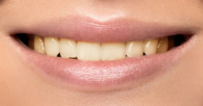 Clareador Odontológico - Dental Access