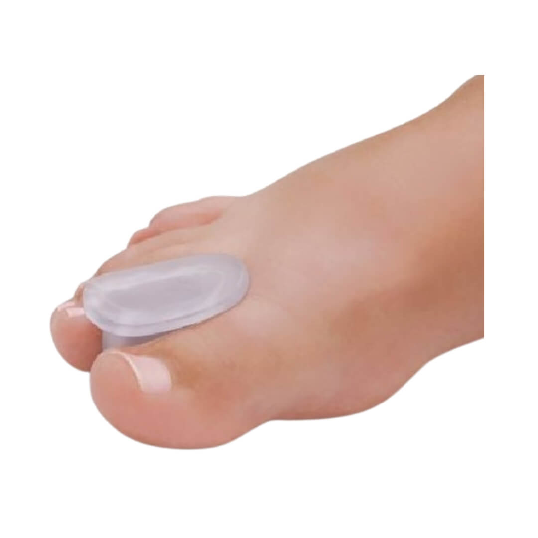 Corretivo de Joanete - Só Pés