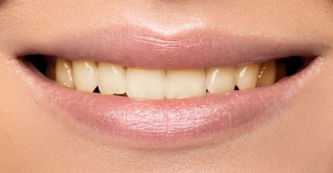 image comparison before