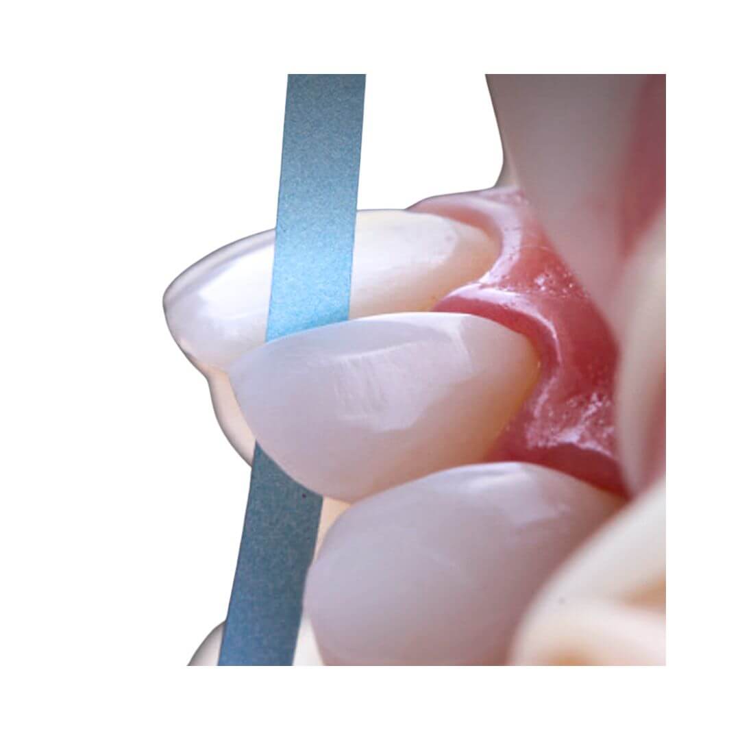 Tira para Acabamento e Polimento EpiGloss - American Burrs - Dental Access